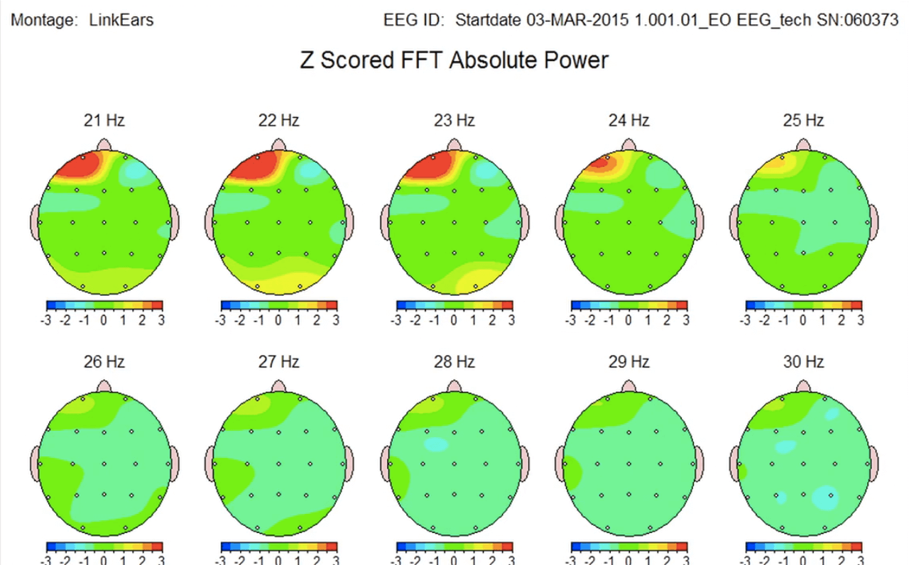 Access Bars Open Your Mind Bewustzijn, Training & Coaching
